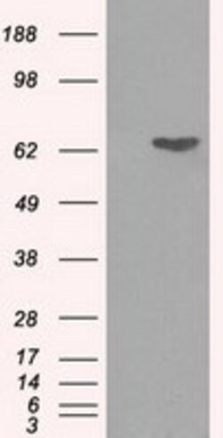 GPI Mouse anti-Human, Clone: OTI5G9, lyophilized, TrueMAB 100 &mu;g | Buy Online | Origene Technologies | Fisher Scientific