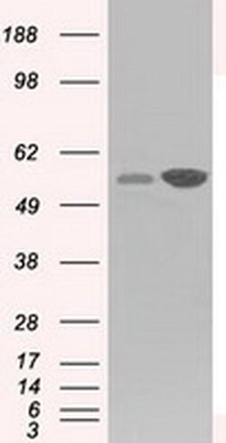 GPI Monoclonal Antibody (OTI5A11), TrueMAB , OriGene 100 &mu;L | Buy Online | OriGene | Fisher Scientific