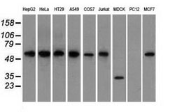 GPI Mouse anti-Human, Clone: OTI2D2, lyophilized, TrueMAB 100 &mu;g; Unconjugated:Antibodies,