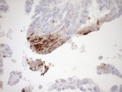 GPNMB Monoclonal Antibody (OTI2A10), TrueMAB , OriGene 100 &mu;L; Unconjugated:Antibodies,