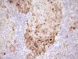 GPNMB Monoclonal Antibody (OTI2A10), TrueMAB , OriGene 100 &mu;L; Unconjugated:Antibodies,