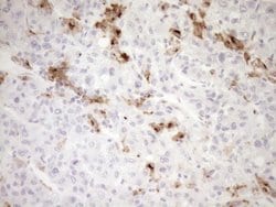 GPNMB Monoclonal Antibody (OTI2A10), TrueMAB , OriGene 100 &mu;L; Unconjugated:Antibodies,