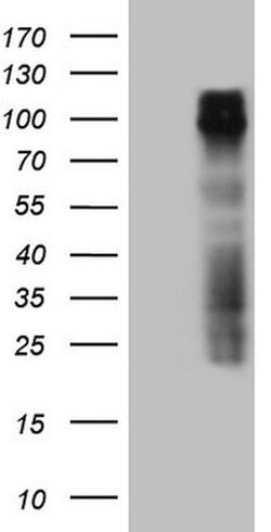 GPNMB Mouse anti-Human, Clone: OTI1E3, lyophilized, TrueMAB 100 &mu;g;