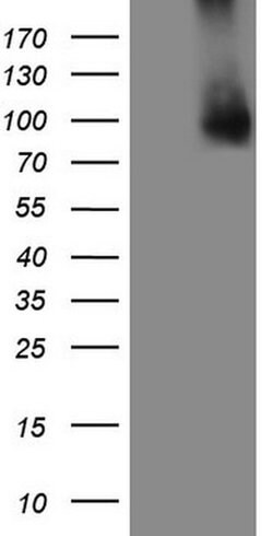 GPNMB Monoclonal Antibody (OTI5C2), TrueMAB , OriGene:Antibodies:Primary