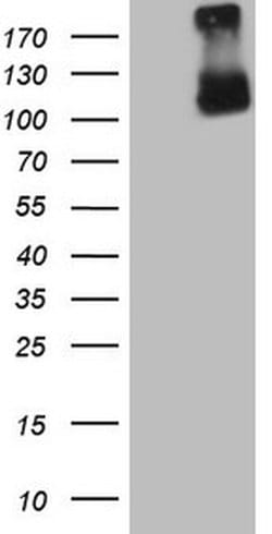 GPNMB Monoclonal Antibody (OTI2A10), TrueMAB , OriGene 100 &mu;L; Unconjugated:Antibodies,