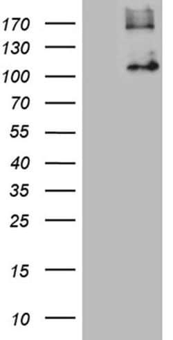 GPNMB Monoclonal Antibody (OTI2E10), TrueMAB , OriGene:Antibodies:Primary