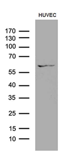 GPR151 Monoclonal Antibody (OTI2B4), TrueMAB , OriGene 100 &mu;L; Unconjugated:Antibodies,