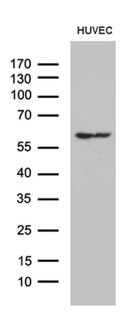 GPR151 Monoclonal Antibody (OTI1D8), TrueMAB , OriGene 100 &mu;L; Unconjugated:Antibodies,