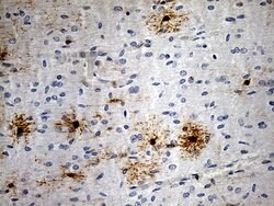 GPR17 Monoclonal Antibody (OTI6A3), TrueMAB , OriGene 100 &mu;L; Unconjugated:Antibodies,