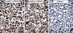 GPR17 Monoclonal Antibody (OTI6A3), TrueMAB , OriGene 100 &mu;L; Unconjugated:Antibodies,