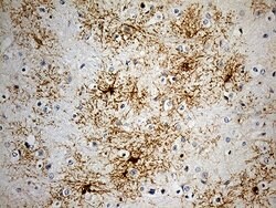 GPR17 Mouse anti-Human, Clone: OTI10B8, lyophilized, TrueMAB 100 &mu;g;