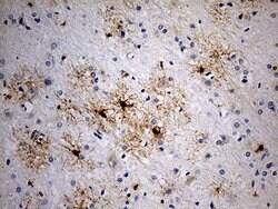 GPR17 Mouse anti-Human, Clone: OTI10B8, lyophilized, TrueMAB 100 &mu;g;