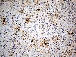 GPR17 Monoclonal Antibody (OTI9D6), TrueMAB , OriGene 30 &mu;L | Buy Online | Origene Technologies | Fisher Scientific