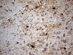 GPR17 Monoclonal Antibody (OTI9D6), TrueMAB , OriGene 30 &mu;L | Buy Online | Origene Technologies | Fisher Scientific