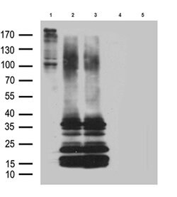 GPR26 Mouse anti-Human, Mouse, Rat, Clone: OTI3D10, lyophilized, TrueMAB