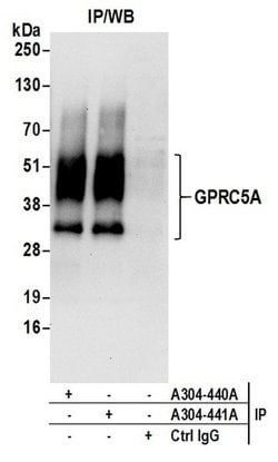 GPRC5A Rabbit anti-Human, Polyclonal, Bethyl Laboratories 100 &mu;L; Unconjugated:Antibodies,