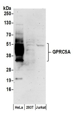 GPRC5A Rabbit anti-Human, Polyclonal, Bethyl Laboratories 100 &mu;L; Unconjugated:Antibodies,