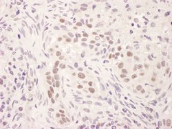 GR Rabbit anti-Human, Polyclonal, Bethyl Laboratories 100 &mu;L; Unconjugated:Antibodies,