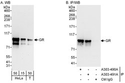 GR Rabbit anti-Human, Polyclonal, Bethyl Laboratories 100 &mu;L; Unconjugated:Antibodies,