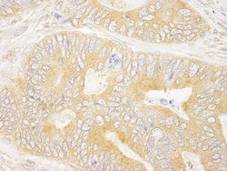 GRB10 Polyclonal Antibody, Bethyl Laboratories 100 &mu;L; Unconjugated:Antibodies,