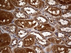 GRB10 Monoclonal Antibody (OTI5A6), TrueMAB , OriGene 100 &mu;L; Unconjugated:Antibodies,