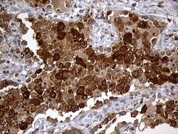 GRB7 Mouse anti-Human, Clone: OTI6H2, TrueMAB , Origene 30 &mu;L | Buy Online | Origene Technologies | Fisher Scientific