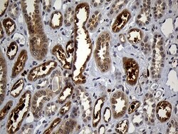 GRB7 Mouse anti-Human, Clone: OTI6H2, TrueMAB , Origene 30 &mu;L | Buy Online | Origene Technologies | Fisher Scientific