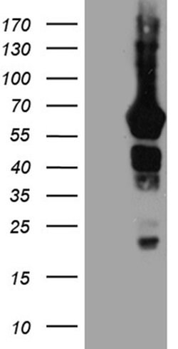 GRB7 Mouse anti-Human, Clone: OTI6H2, TrueMAB , Origene 30 &mu;L | Buy Online | Origene Technologies | Fisher Scientific