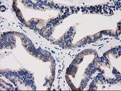 GRHPR Mouse anti-Human, Clone: OTI10A3, lyophilized, TrueMAB 100 &mu;g;
