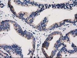 GRHPR Monoclonal Antibody (OTI10A3), TrueMAB , OriGene 100 &mu;L; Unconjugated:Antibodies,