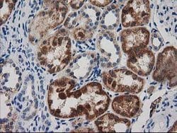 GRHPR Mouse anti-Human, Clone: OTI10A3, lyophilized, TrueMAB 100 &mu;g;