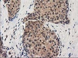 GRHPR Monoclonal Antibody (OTI2H4), TrueMAB , OriGene 100 &mu;L; Unconjugated:Antibodies,