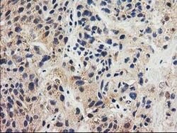 GRHPR Monoclonal Antibody (OTI2H4), TrueMAB , OriGene 100 &mu;L; Unconjugated:Antibodies,