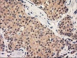 GRHPR Mouse anti-Human, Clone: OTI1H8, lyophilized, TrueMAB 100 &mu;g;