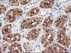 GRHPR Mouse anti-Human, Clone: OTI1H8, lyophilized, TrueMAB 100 &mu;g;