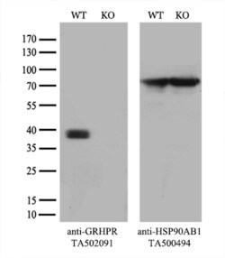 GRHPR Monoclonal Antibody (OTI2H4), TrueMAB , OriGene 30 &mu;L; Unconjugated:Antibodies,