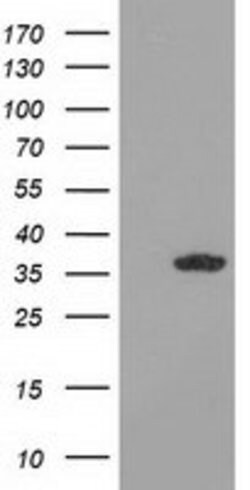 GRHPR Mouse anti-Human, Clone: OTI9G2, lyophilized, TrueMAB 100 &mu;g;