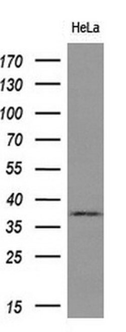 GRHPR Mouse anti-Human, Clone: OTI9G2, lyophilized, TrueMAB 100 &mu;g;