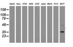 GRHPR Monoclonal Antibody (OTI9E6), TrueMAB , OriGene:Antibodies:Primary