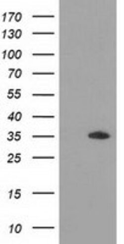 GRHPR Mouse anti-Human, Clone: OTI10A3, lyophilized, TrueMAB 100 &mu;g;