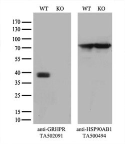 GRHPR Monoclonal Antibody (OTI2H4), TrueMAB , OriGene 100 &mu;L; Unconjugated:Antibodies,