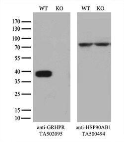 GRHPR Mouse anti-Human, Clone: OTI1H8, lyophilized, TrueMAB 100 &mu;g;