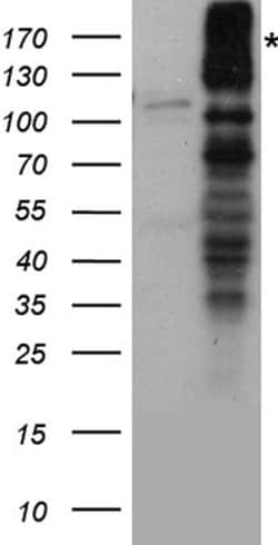 GRIN2A Rabbit anti-Human, Mouse, Rat, Polyclonal, liquid, OriGene 100 &mu;L;