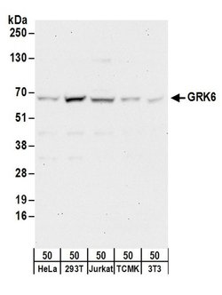GRK6 Rabbit anti-Human, Mouse, Polyclonal, Bethyl Laboratories 100 &mu;L | Buy Online | Bethyl Laboratories, Inc | Fisher Scientific