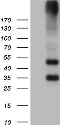 GRM4 Mouse anti-Human, Clone: OTI6D1, TrueMAB , Origene 30 &mu;L; Unconjugated:Antibodies,