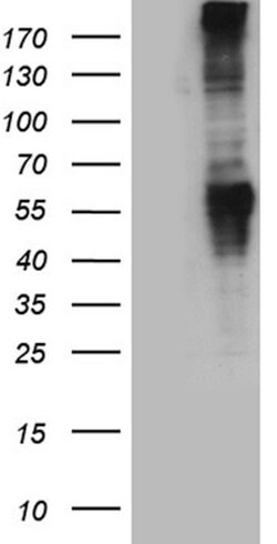 GRM5 Rabbit anti-Human, Polyclonal, liquid, OriGene 100 &mu;L; Unconjugated:Antibodies,