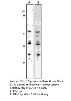 GSK3 beta Chicken anti-Human, Mouse, Rat, Polyclonal, FabGennix 200 &mu;L;