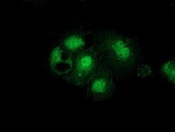 GSS Monoclonal Antibody (OTI2F2), TrueMAB , OriGene:Antibodies:Primary