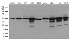 GSS Monoclonal Antibody (OTI2F2), TrueMAB , OriGene 30 &mu;L; Unconjugated:Antibodies,
