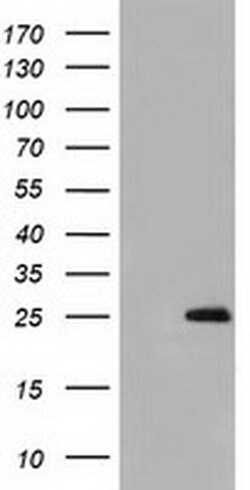 GSTA4 Mouse anti-Human, Clone: OTI1E2, liquid, TrueMAB 30 &mu;L; Unconjugated:Antibodies,